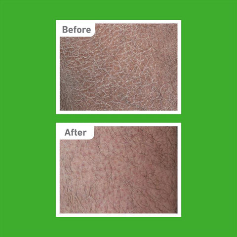 Skin before & after using O'Keeffe's Working Hands hand & body lotion